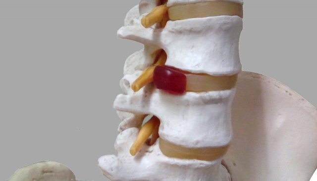 痛みは腰の神経が圧迫されることが原因